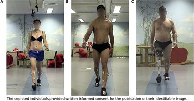 Benchmarking Stability of Bipedal Locomotion Based on Individual Full Body Dynamics and Foot Placement Strategies–Application to Impaired and Unimpaired Walking